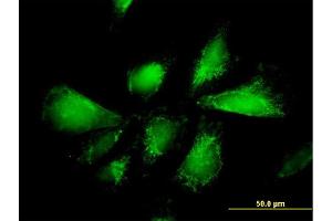 Immunofluorescence of monoclonal antibody to SLC25A13 on HepG2 cell.