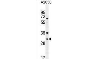 Western Blotting (WB) image for anti-ARV1 Homolog (ARV1) antibody (ABIN2995757) (ARV1 anticorps)
