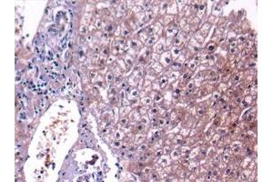 Detection of C4 in Human Liver Tissue using Polyclonal Antibody to Complement Component 4 (C4)