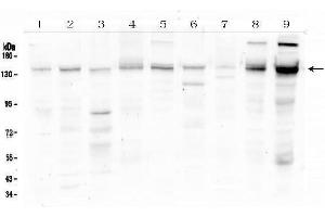 Western blot analysis of HDAC5 using anti-HDAC5 antibody (ABIN6719321). (HDAC5 anticorps  (AA 102-197))