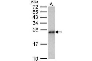 WB Image Sample (30 ug of whole cell lysate) A: Hep G2 , 15% SDS PAGE antibody diluted at 1:1000 (CARHSP1 anticorps)