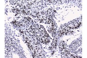 IHC analysis of nmt55/p54nrb using anti-nmt55/p54nrb antibody (ABIN3044530).