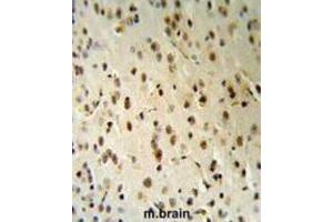 Immunohistochemistry (IHC) image for anti-threonyl-tRNA Synthetase-Like 2 (TARSL2) antibody (ABIN3003853) (TARSL2 anticorps)