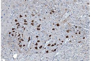 IHC analysis of MAP3K8 using anti-MAP3K8 antibody (ABIN4886663). (MAP3K8 anticorps  (AA 9-193))