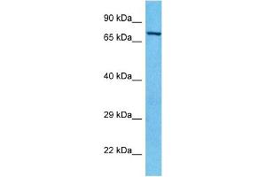 Host:  Rabbit  Target Name:  PAK6  Sample Type:  HepG2 Whole Cell lysates  Antibody Dilution:  1.