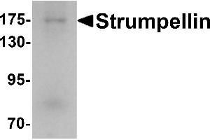 Western blot analysis of Strumpellin in human ovary tissue lysate with Strumpellin antibody at 1 µg/mL.