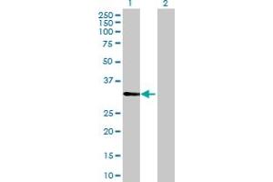 Western Blot analysis of CDV3 expression in transfected 293T cell line by CDV3 MaxPab polyclonal antibody. (CDV3 anticorps  (AA 1-213))