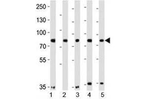 Western blot analysis of lysate from 1) A549, 2) HeLa, 3) MCF-7, 4) SH-SY5Y and 5) SW480 cell lines using Insulin Receptor Related antibody at 1:1000.