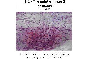 Image no. 2 for anti-Transglutaminase 2 (C Polypeptide, Protein-Glutamine-gamma-Glutamyltransferase) (TGM2) antibody (ABIN346957) (Transglutaminase 2 anticorps)