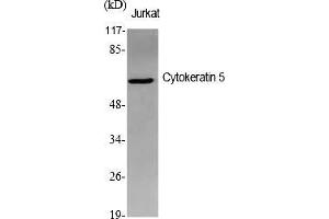 Western Blot analysis of various cells using Cytokeratin 5 Polyclonal Antibody diluted at 1:1000. (Cytokeratin 5 anticorps  (AA 510-590))