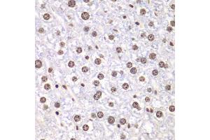 Immunohistochemistry of paraffin-embedded mouse liver using TOP1 antibody. (Topoisomerase I anticorps  (AA 1-100))