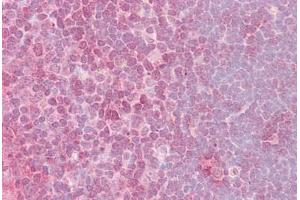 Anti-CRKL antibody IHC staining of human thymus. (CrkL anticorps  (AA 292-303))