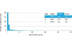 Analysis of Protein Array containing more than 19,000 full-length human proteins using Spectrin, alpha 1 Mouse Monoclonal Antibody (SPTA1/1832) Z- and S- Score: The Z-score represents the strength of a signal that a monoclonal antibody (MAb) (in combination with a fluorescently-tagged anti-IgG secondary antibody) produces when binding to a particular protein on the HuProtTM array.