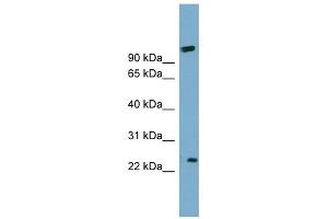 ARL8B antibody used at 1 ug/ml to detect target protein. (ARL8B anticorps  (Middle Region))