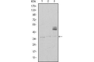 Western blot analysis using CD1A mouse mAb against K562 (1), RAJI (2), and MOLT4 (3) cell lysate.
