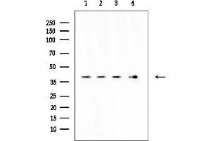 anti-Inorganic Phosphate Transporter 1 (PI-T1) antibody