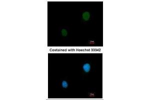 ICC/IF Image Immunofluorescence analysis of methanol-fixed HeLa, using PKA 2 beta, antibody at 1:200 dilution. (PKA 2 beta (Center) anticorps)