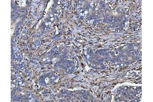 IHC analysis of HLA-DRA using anti-HLA-DRA antibody (ABIN7600948). (HLA-DRA anticorps  (AA 26-254))