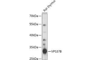 Western blot analysis of extracts of Rat thymus, using VPS37B antibody (ABIN7271278) at 1:1000 dilution. (VPS37B anticorps  (AA 60-170))