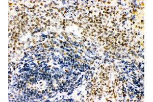 Anti- CTBP1 Picoband antibody, IHC(P) IHC(P): Rat Spleen Tissue (CTBP1 anticorps  (C-Term))