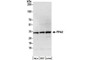 Western Blotting (WB) image for anti-Pyrophosphatase 2 (PPA2) (AA 25-75) antibody (ABIN7450586)