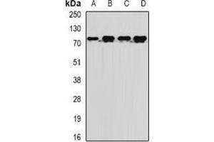 Western blot analysis of MTMR14 expression in BT474 (A), Jurkat (B), mouse liver (C), rat brain (D) whole cell lysates. (MTMR14 anticorps)