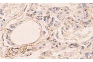 Immunohistochemical staining of formalin-fixed paraffin-embedded human lung showing staining with ANGPT4 polyclonal antibody  at 1:100 dilution. (Angiopoietin 4 anticorps)
