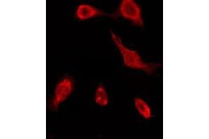 ABIN6276162 staining COLO205 by IF/ICC. (OR51A7 anticorps  (C-Term))