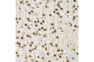 Immunohistochemistry of paraffin-embedded mouse brain using UMPS antibody (ABIN5973202) at dilution of 1/200 (40x lens). (UMPS anticorps)