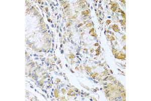 Immunohistochemistry of paraffin-embedded human stomach using RNASE13 antibody at dilution of 1:100 (40x lens). (RNASE13 anticorps)