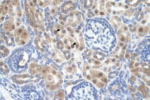 anti-Armadillo Repeat Containing, X-Linked 6 (ARMCX6) (AA 64-113) antibody