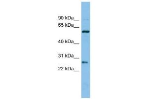 Chymotrypsinogen B1 antibody used at 1 ug/ml to detect target protein. (CTRB1 anticorps  (Middle Region))
