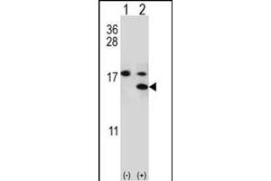Western blot analysis of S100A11 (arrow) using rabbit polyclonal S100A11 Antibody (S6) (ABIN389308 and ABIN2839429). (S100A11 anticorps  (AA 1-30))