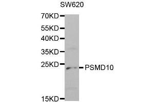 Western blot analysis of extracts of SW620 cell lines, using PSMD10 antibody.