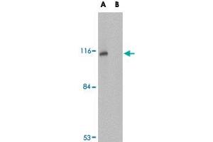 Western blot analysis of JPH3 in Daudi cell lysate with JPH3 polyclonal antibody  at 1 ug/mL in (A) the absence and (B) the presence of blocking peptide. (Junctophilin 3 anticorps  (Internal Region))