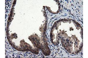 Image no. 9 for anti-CCR4-NOT Transcription Complex Subunit 4 (CNOT4) (AA 190-455) antibody (ABIN1491098) (CNOT4 anticorps  (AA 190-455))