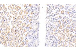 Detection of CD163 in Mouse Stomach Tissue using Polyclonal Antibody to Cluster Of Differentiation (CD163)