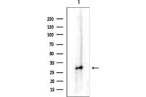 Western blot analysis of lysates from COLO205 cells(heat-shock treatment), using PSM Antibody at 1/1000 dilution.