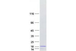Validation with Western Blot