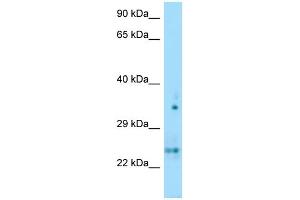 WB Suggested Anti-OLIG1 Antibody Titration: 1. (OLIG1 anticorps  (N-Term))