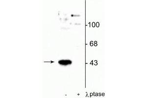 Western blot of human T47D cells showing specific immunolabeling of the ~45 kDa MEK 1 protein phosphorylated at Thr386 in the first lane (-). (MEK1 anticorps  (pThr386))