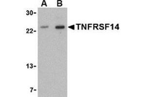 Western blot analysis of TNFRSF14 in mouse thymus tissue lysate with this product at (A) 1 and (B) 2 μg/ml. (HVEM anticorps  (N-Term))