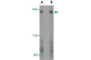 Western blot analysis of GPR124 in human bladder tissue lysate with GPR124 polyclonal antibody  at (A) 2 and (B) 4 ug/mL . (GPR124 anticorps  (C-Term))