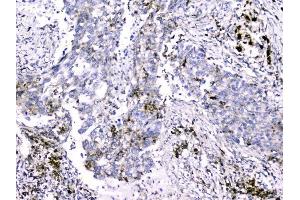 IHC analysis of Cytochrome C using anti-Cytochrome C antibody (ABIN5693008). (Cytochrome C anticorps  (AA 2-105))