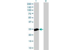 Western Blot analysis of RALB expression in transfected 293T cell line by RALB monoclonal antibody (M04), clone 4D1. (RALB anticorps  (AA 89-183))