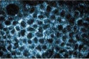 Immunofluorescence staining of A431 cells (Human epithelial carcinoma, ATCC CRL-1555). (PEX1 anticorps  (AA 1049-1256))