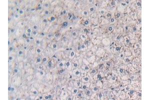 Detection of MCP1 in Human Liver Tissue using Polyclonal Antibody to Monocyte Chemotactic Protein 1 (MCP1)