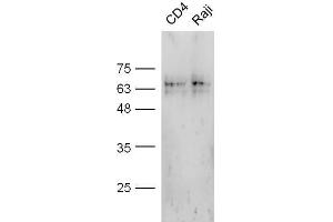 Mouse stomach probed with Anti-CD4 Polyclonal Antibody, Unconjugated  at 1:5000 for 90 min at 37˚C.