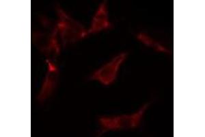 ABIN6275591 staining  Hela cells by IF/ICC. (ATP1A2 anticorps  (N-Term))