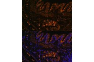 Immunofluorescence analysis of rat lung using MMP9 antibody (ABIN3022899, ABIN3022900, ABIN3022901, ABIN1513215 and ABIN6219286) at dilution of 1:100.